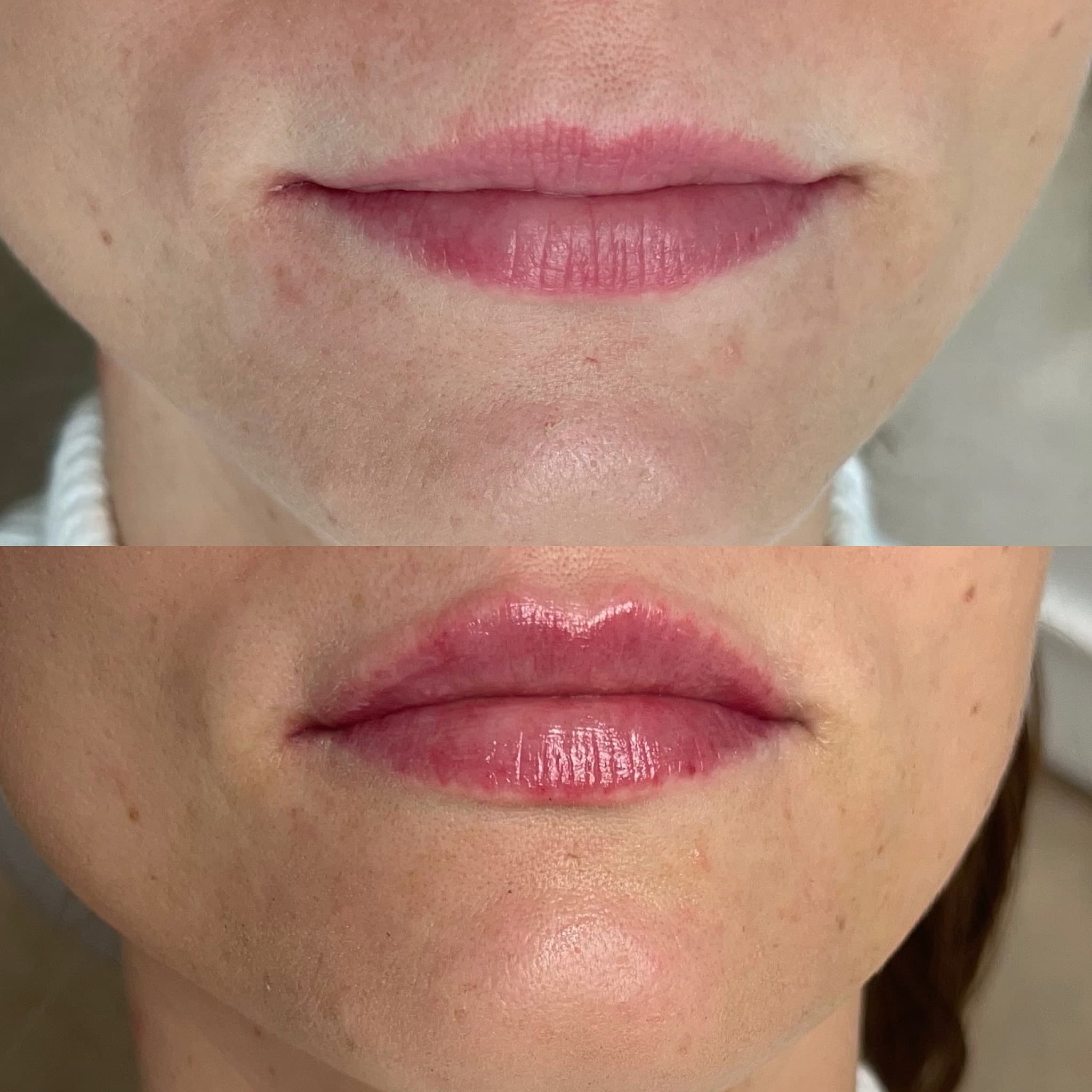 Estetická medicína